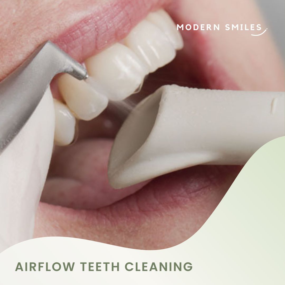 Airflow Teeth Cleaning Modern Smiles