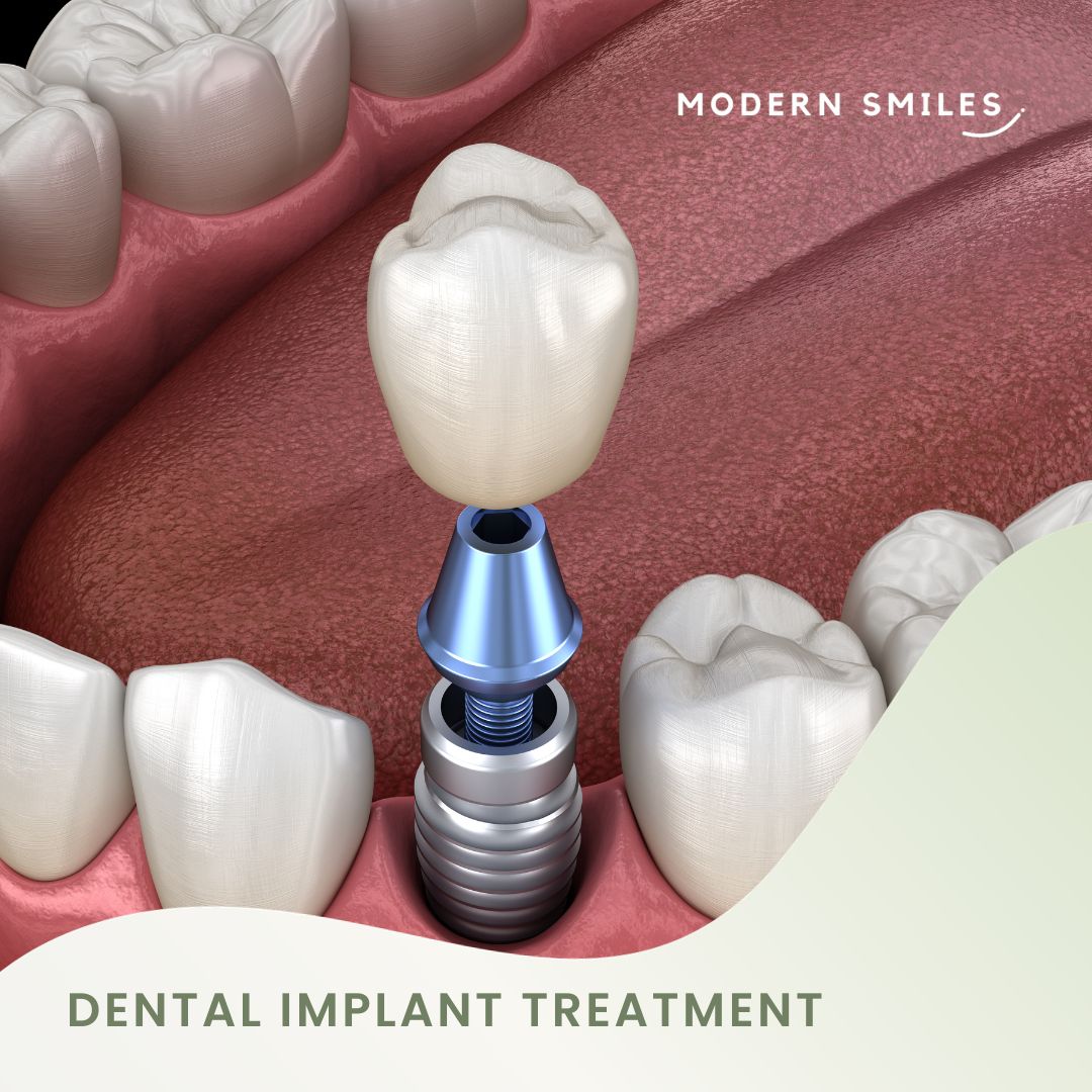 Dental Implant Treatment