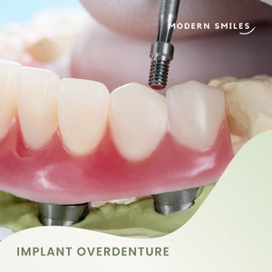 Dental Implant Treatment