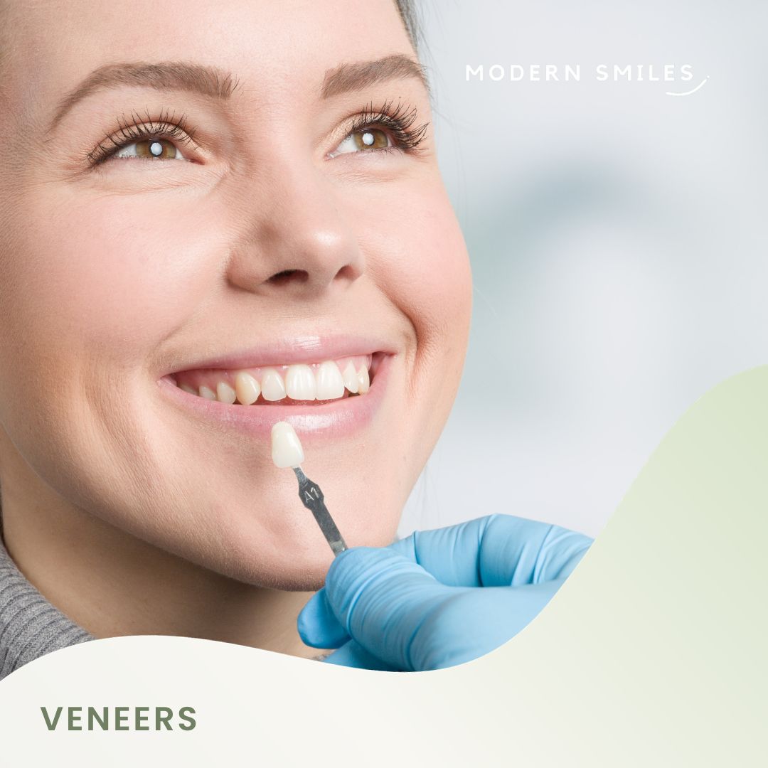 Veneers