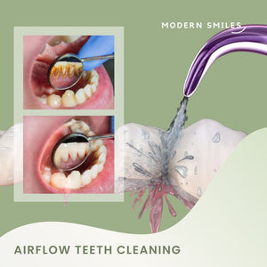 Oral Prophylaxis