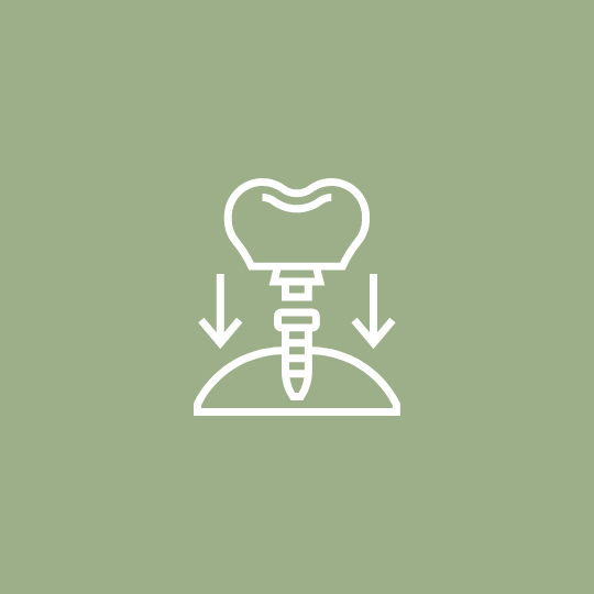 Dental Implant Treatment