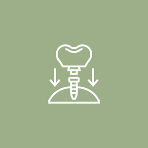 Dental Implant Treatment